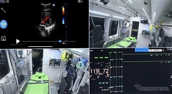 エクモカー内から送られる映像イメージ。左上:患者のエコー画像、右上:車内のLiveU映像、左下:車内のLiveU映像、右下:患者の血圧などの医用情報(バイタルデータ)《画像提供 NTTドコモ》